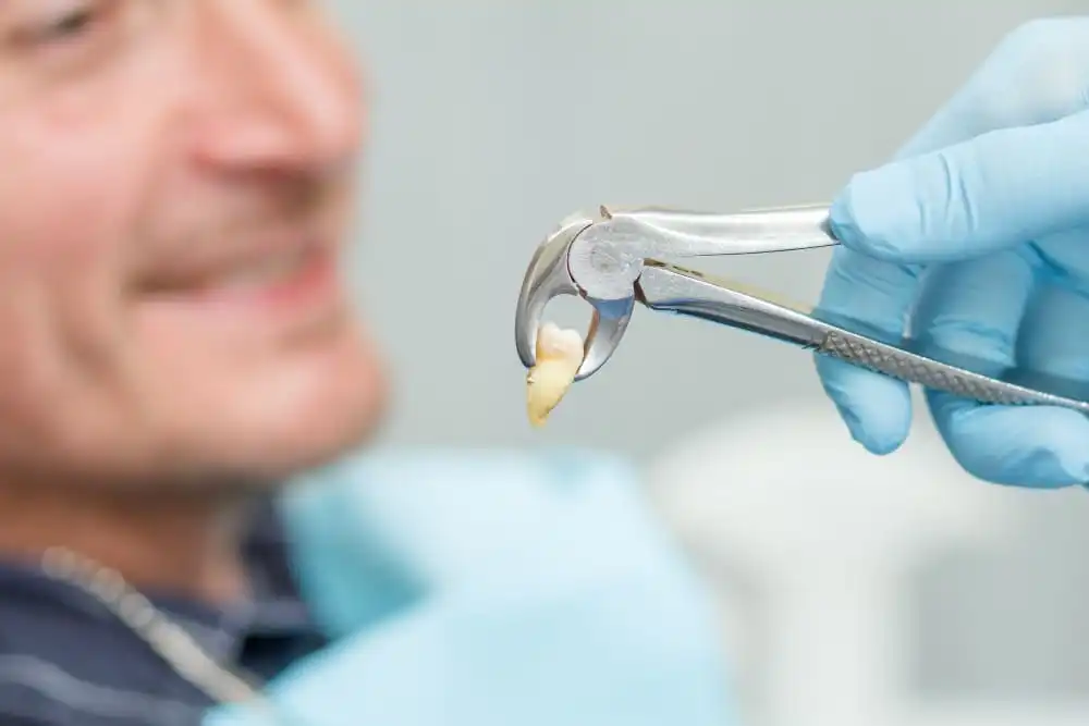 Estrazione dentale prezzi