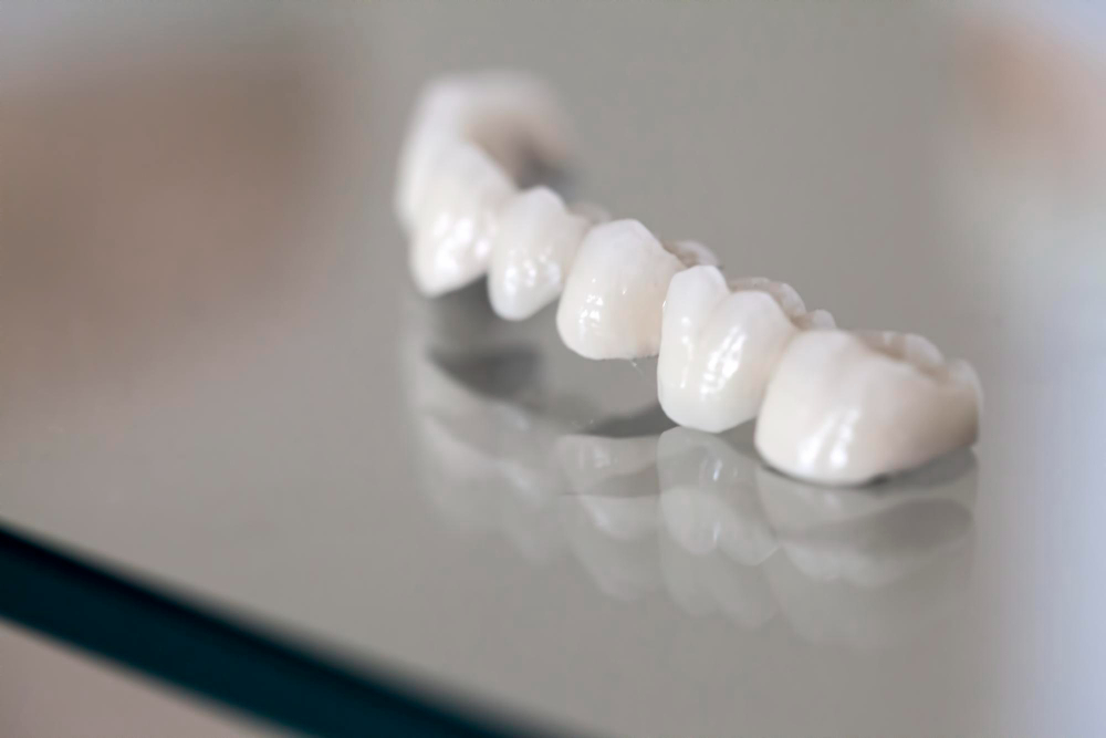 Zirconio denti: perché non è sempre la scelta migliore?