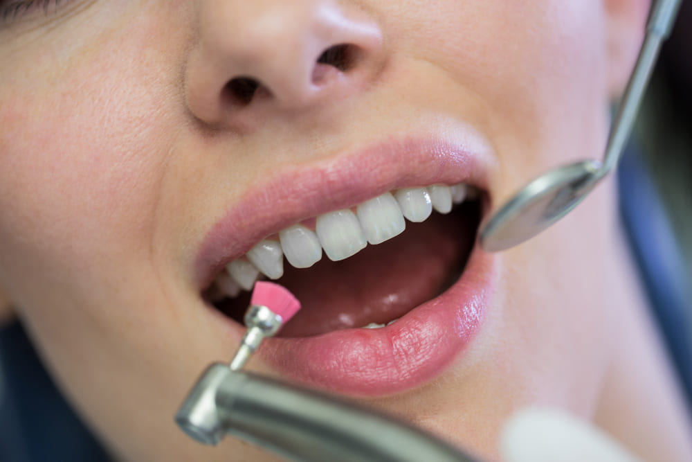 Dolore pulizia dei denti: cause, soluzioni, casi più frequenti e come gestirli